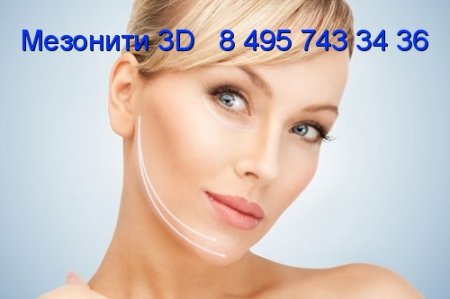 Мезонити 3D